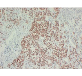 Immunohistochemistry - Anti-Growth Hormone Antibody (V0079) - Antibodies.com