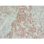 Immunohistochemistry - Anti-Growth Hormone Antibody (V0079) - Antibodies.com