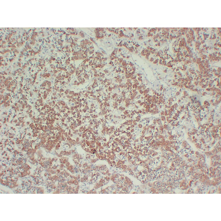 Immunohistochemistry - Anti-Growth Hormone Antibody (V0079) - Antibodies.com