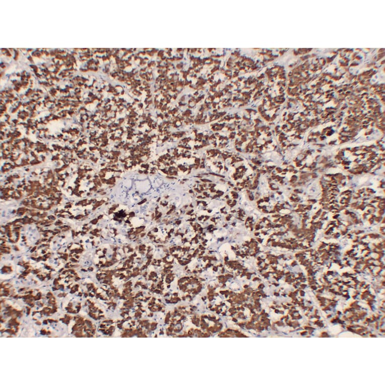 Immunohistochemistry - Anti-Growth Hormone Antibody (V0079) - Antibodies.com