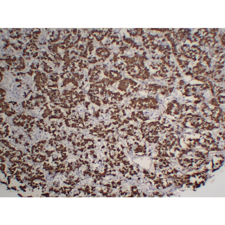 Immunohistochemistry - Anti-Growth Hormone Antibody (V0079) - Antibodies.com