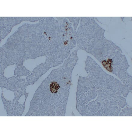 Immunohistochemistry - Anti-Synaptophysin Antibody (V0127) - Antibodies.com