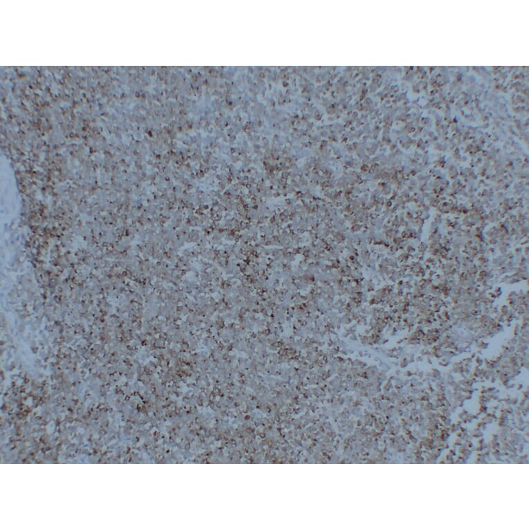 Immunohistochemistry - Anti-Synaptophysin Antibody (V0127) - Antibodies.com