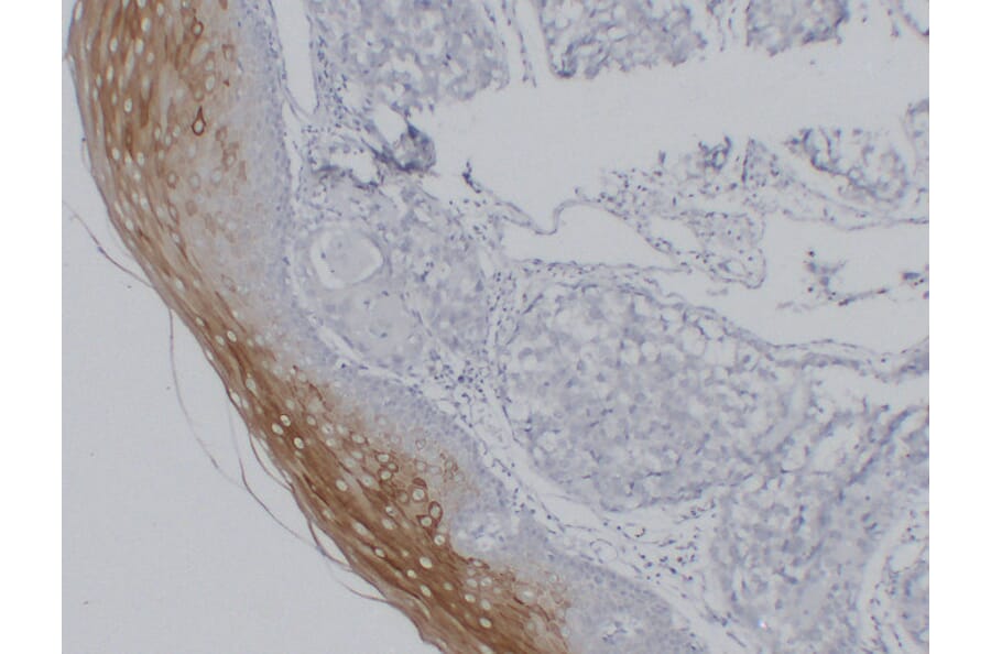Immunohistochemistry - Anti-Cytokeratin 4 Antibody (V0053) - Antibodies.com