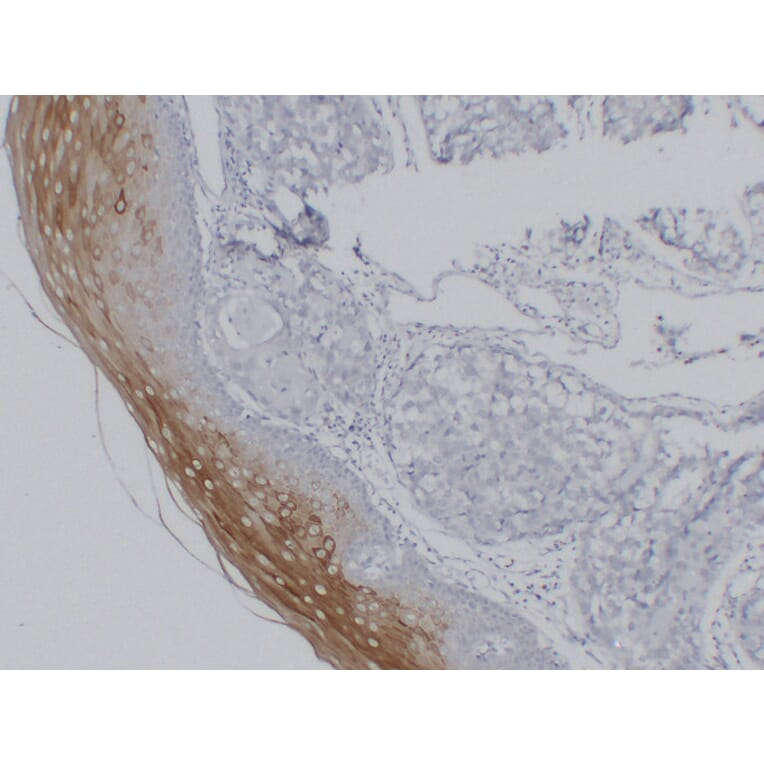 Immunohistochemistry - Anti-Cytokeratin 4 Antibody (V0053) - Antibodies.com