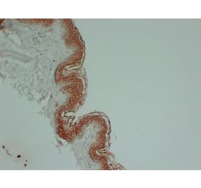 Immunohistochemistry - Anti-Cytokeratin 1 Antibody (V0043) - Antibodies.com