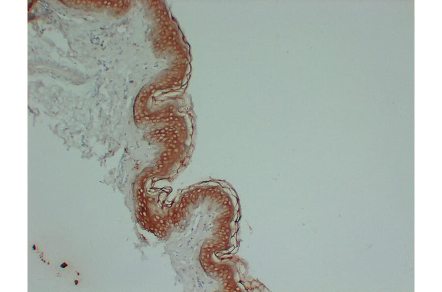 Immunohistochemistry - Anti-Cytokeratin 1 Antibody (V0043) - Antibodies.com