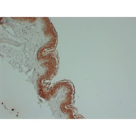 Immunohistochemistry - Anti-Cytokeratin 1 Antibody (V0043) - Antibodies.com