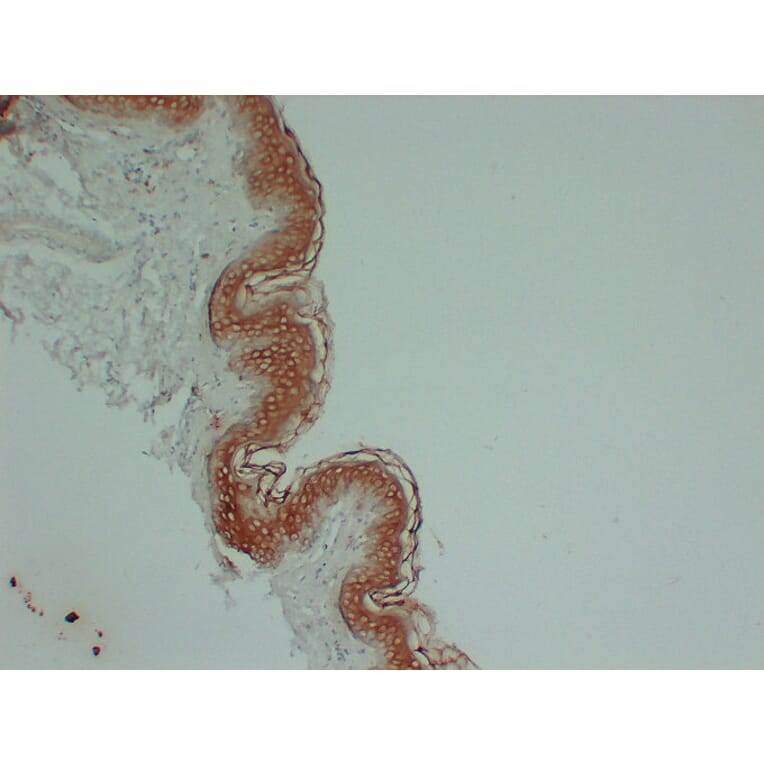 Immunohistochemistry - Anti-Cytokeratin 1 Antibody (V0043) - Antibodies.com