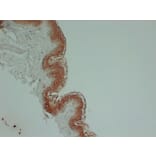 Immunohistochemistry - Anti-Cytokeratin 1 Antibody (V0043) - Antibodies.com