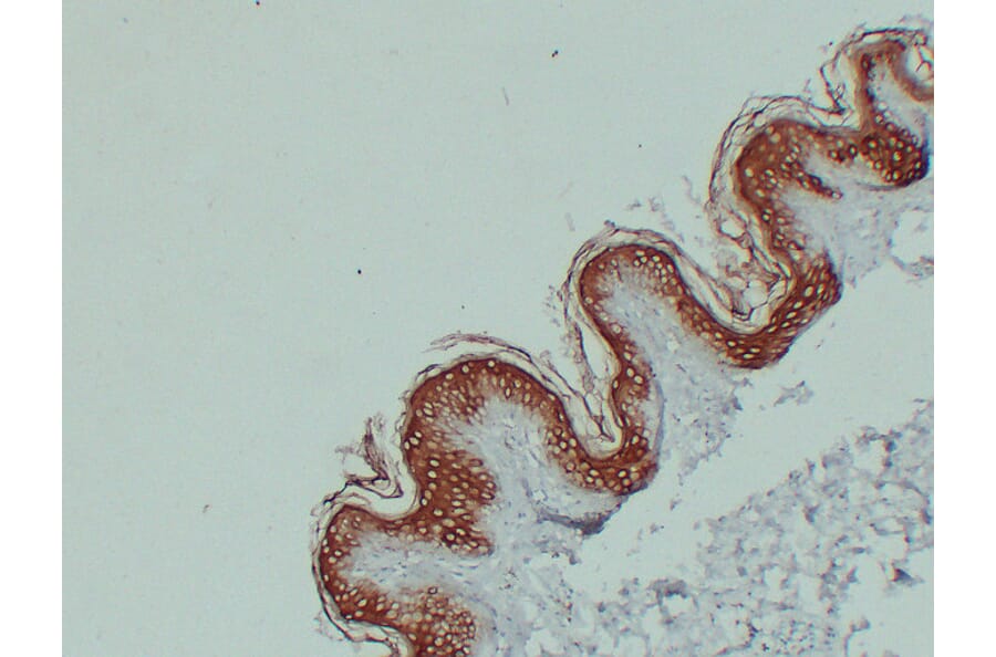 Immunohistochemistry - Anti-Cytokeratin 1 Antibody (V0043) - Antibodies.com