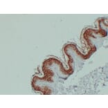 Immunohistochemistry - Anti-Cytokeratin 1 Antibody (V0043) - Antibodies.com