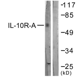Western Blot - Anti-IL-10R alpha Antibody (B1056) - Antibodies.com