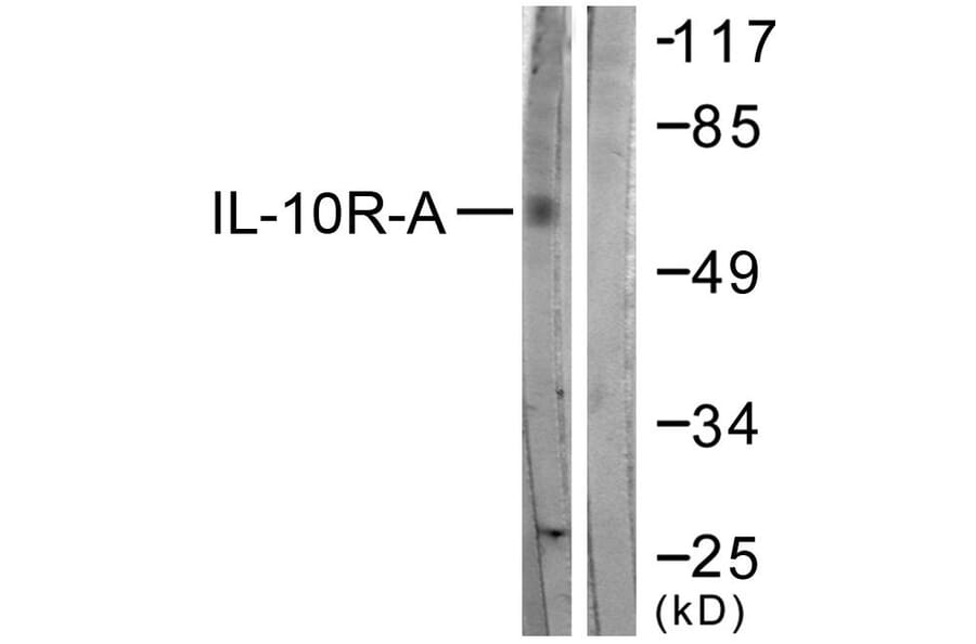 Western Blot - Anti-IL-10R alpha Antibody (B1056) - Antibodies.com