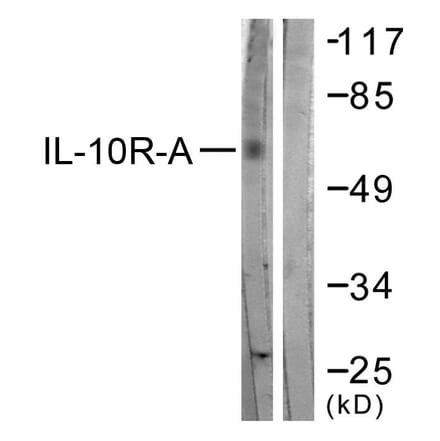 Western Blot - Anti-IL-10R alpha Antibody (B1056) - Antibodies.com