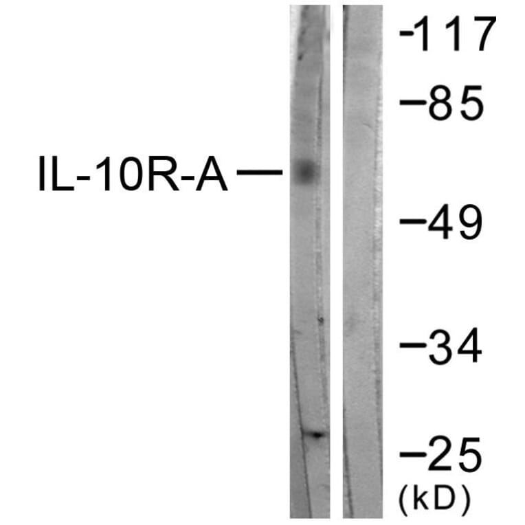 Western Blot - Anti-IL-10R alpha Antibody (B1056) - Antibodies.com