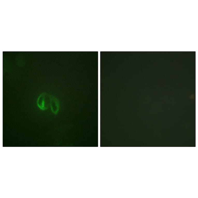 Immunofluorescence - Anti-IL-10R alpha Antibody (B1056) - Antibodies.com