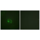 Immunofluorescence - Anti-IL-10R alpha Antibody (B1056) - Antibodies.com