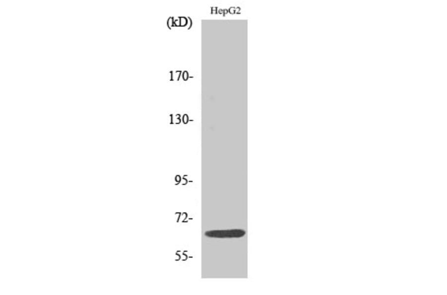 Western Blot - Anti-IL-10R alpha Antibody (B1056) - Antibodies.com