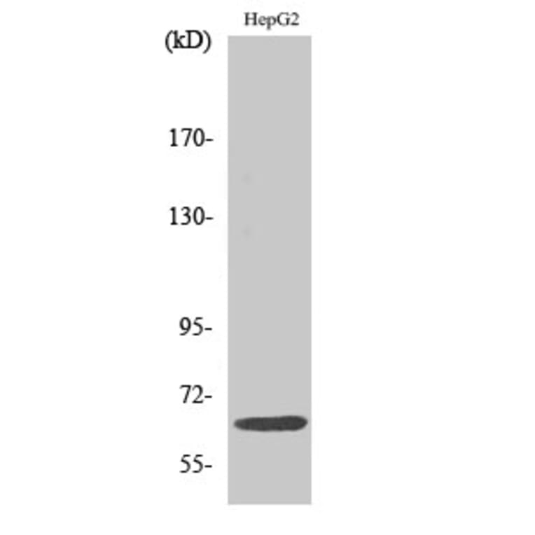 Western Blot - Anti-IL-10R alpha Antibody (B1056) - Antibodies.com