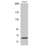 Western Blot - Anti-IL-10R alpha Antibody (B1056) - Antibodies.com