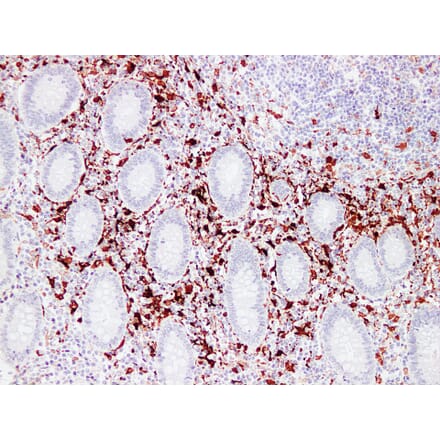 Immunohistochemistry - Anti-Factor XIIIa Antibody (V0070) - Antibodies.com