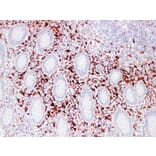 Immunohistochemistry - Anti-Factor XIIIa Antibody (V0070) - Antibodies.com