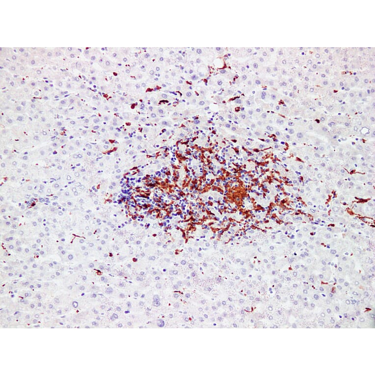 Immunohistochemistry - Anti-Factor XIIIa Antibody (V0070) - Antibodies.com