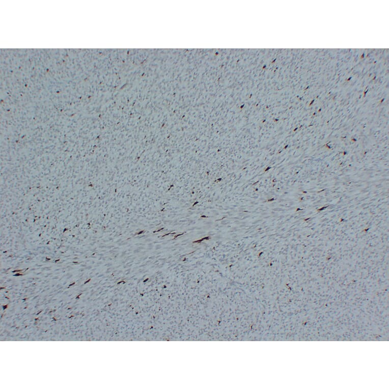 Immunohistochemistry - Anti-Factor XIIIa Antibody (V0070) - Antibodies.com