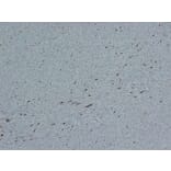 Immunohistochemistry - Anti-Factor XIIIa Antibody (V0070) - Antibodies.com