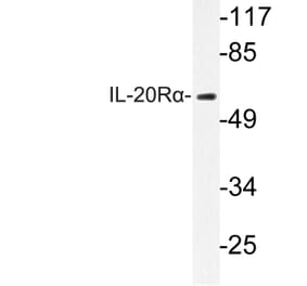 Western Blot - Anti-IL-20Ralpha Antibody (R12-2207) - Antibodies.com