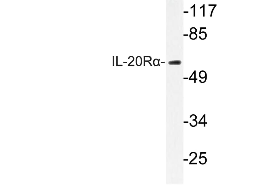 Western Blot - Anti-IL-20Ralpha Antibody (R12-2207) - Antibodies.com