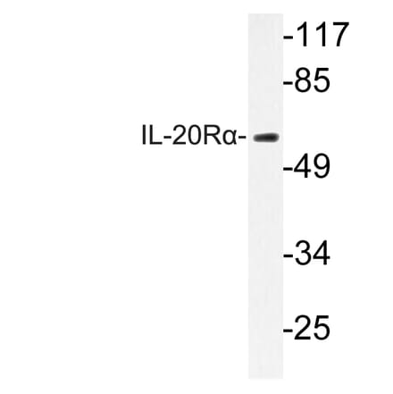 Western Blot - Anti-IL-20Ralpha Antibody (R12-2207) - Antibodies.com