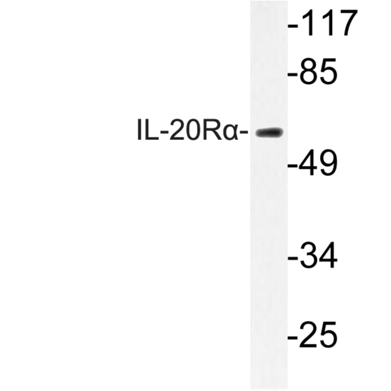 Western Blot - Anti-IL-20Ralpha Antibody (R12-2207) - Antibodies.com