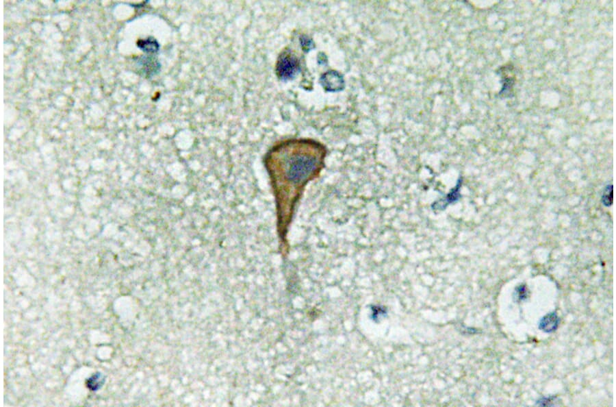 Immunohistochemistry - Anti-IL-20Ralpha Antibody (R12-2207) - Antibodies.com