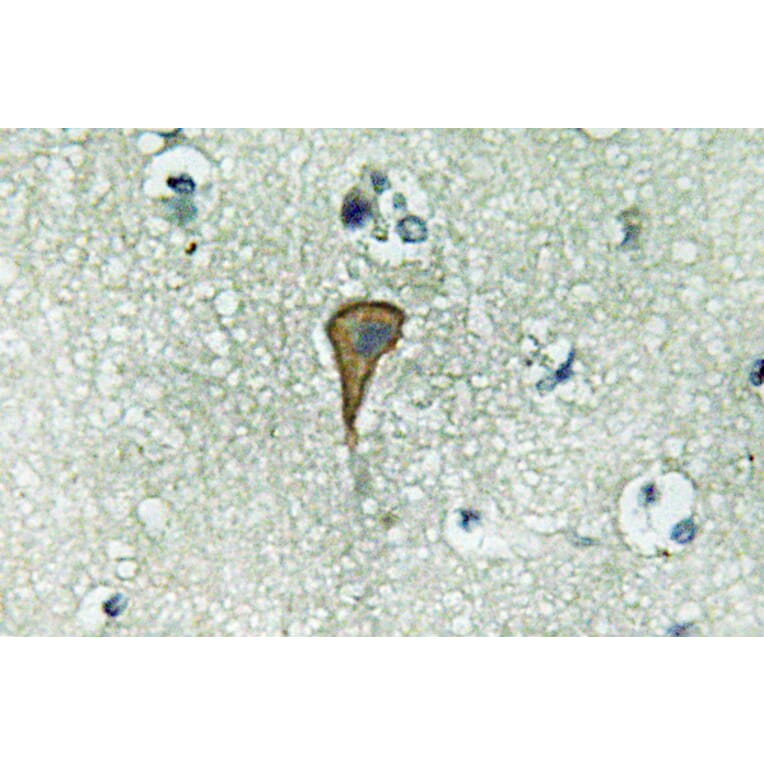 Immunohistochemistry - Anti-IL-20Ralpha Antibody (R12-2207) - Antibodies.com