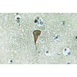 Immunohistochemistry - Anti-IL-20Ralpha Antibody (R12-2207) - Antibodies.com