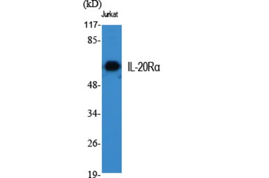 Western Blot - Anti-IL-20Ralpha Antibody (R12-2207) - Antibodies.com