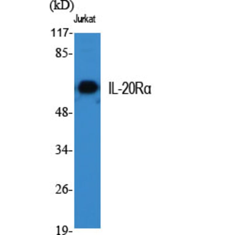 Western Blot - Anti-IL-20Ralpha Antibody (R12-2207) - Antibodies.com