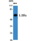 Western Blot - Anti-IL-20Ralpha Antibody (R12-2207) - Antibodies.com