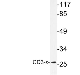 Western Blot - Anti-CD3-epsilon Antibody (R12-2078) - Antibodies.com