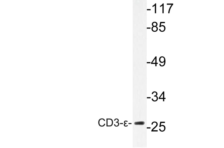 Western Blot - Anti-CD3-epsilon Antibody (R12-2078) - Antibodies.com