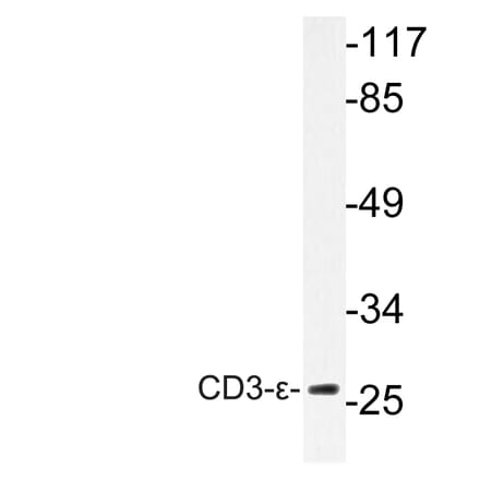 Western Blot - Anti-CD3-epsilon Antibody (R12-2078) - Antibodies.com