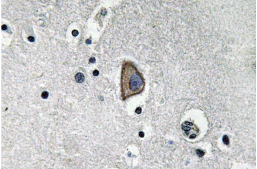 Immunohistochemistry - Anti-CD3-epsilon Antibody (R12-2078) - Antibodies.com