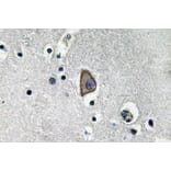 Immunohistochemistry - Anti-CD3-epsilon Antibody (R12-2078) - Antibodies.com