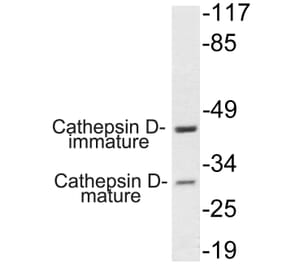 Western Blot - Anti-Cathepsin D Antibody (R12-2059) - Antibodies.com