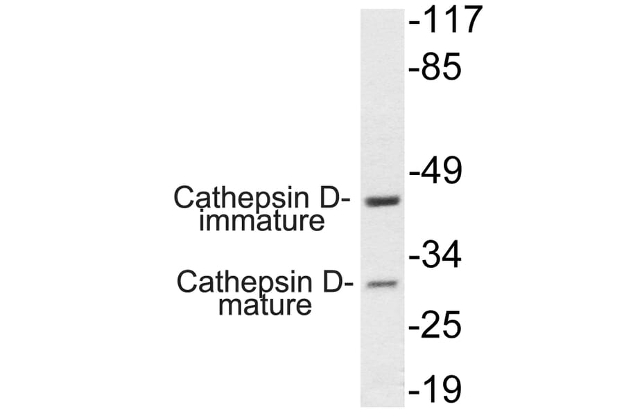 Western Blot - Anti-Cathepsin D Antibody (R12-2059) - Antibodies.com