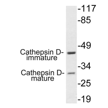 Western Blot - Anti-Cathepsin D Antibody (R12-2059) - Antibodies.com