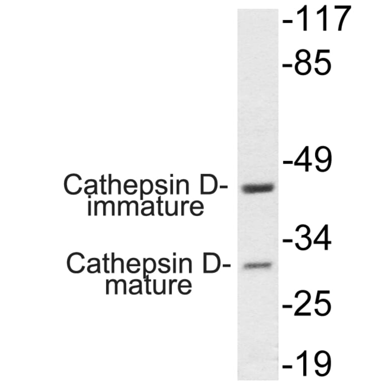 Western Blot - Anti-Cathepsin D Antibody (R12-2059) - Antibodies.com