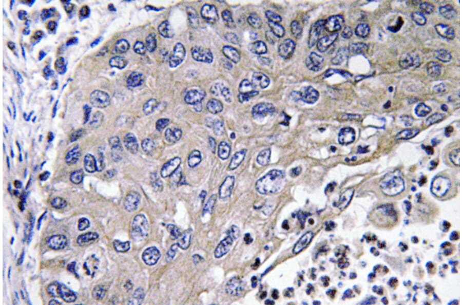 Immunohistochemistry - Anti-Cathepsin D Antibody (R12-2059) - Antibodies.com